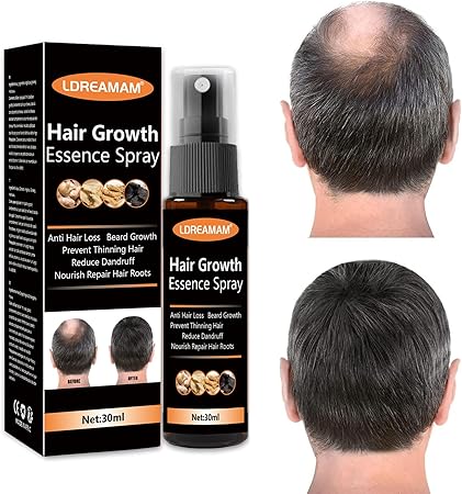 Hair Regrowth Spray For Men